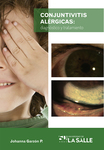 Conjuntivitis alérgicas: diagnóstico y tratamiento by Sandra Johanna Garzón Parra